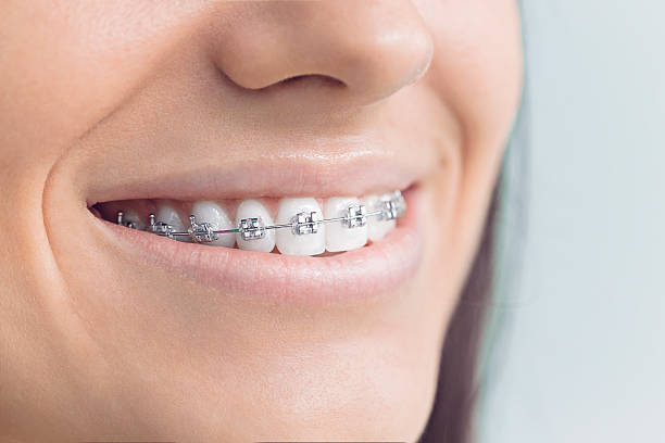 Full Mouth Reconstruction in Elkhart Lake, WI